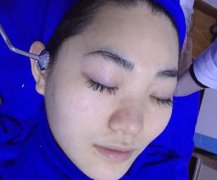 新手加盟祛痘祛斑店，成功也能轻松复制