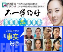 无懈可击的加盟实力，素颜清由衷欢迎滨州加盟商加入